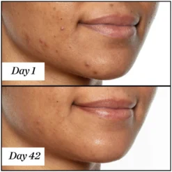 Sunday Riley U.F.O. Ultra-Clarifying Face Oil 15ml -Maison Margiela 11588286 1354882145066268