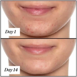 Sunday Riley U.F.O. Ultra-Clarifying Face Oil 15ml -Maison Margiela 11588286 2024882145117634