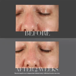 Kate Somerville KateCeuticals Resurfacing Overnight Peel 30ml -Maison Margiela 12753670 1944912025580600