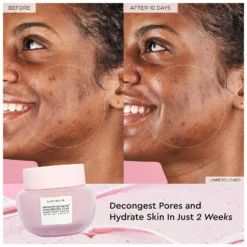 Glow Recipe Watermelon Glow Hyaluronic Clay Pore-Tight Facial 60ml 9 Glow Recipe Watermelon Glow Hyaluronic Clay Pore-Tight Facial 60ml -Maison Margiela 13310762 2214900774341378